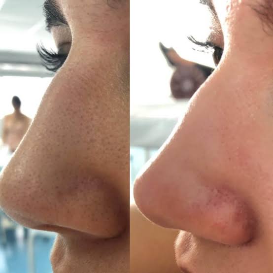 images-2022-06-14T115524.772